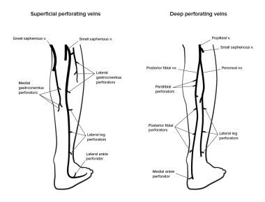 Perforating veins of lower leg. 