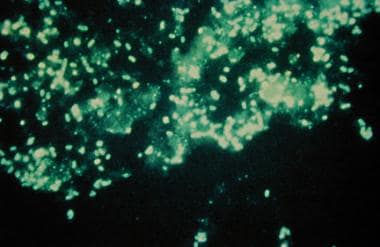 Sputum direct fluorescent antibody stain showing L