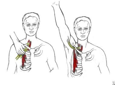 Pectoral focal (left) and regional (right) stress 