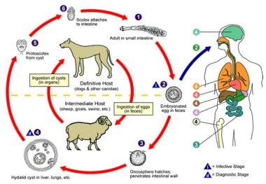 Diagram of the Echinococcus life cycle. Image cour