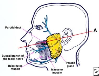 Anatomy of the parotid region. Line A connecting t