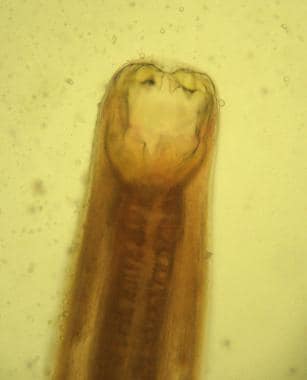 Adult Ancylostoma duodenale worm. Anterior end wit