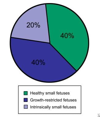 Fetal growth restriction. Distribution of small fe