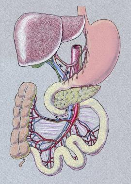 Multivisceral graft, including stomach-liver-pancr