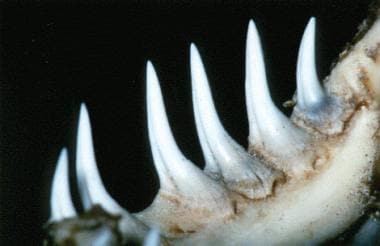 The dentition of a Gila monster. The grooved surfa