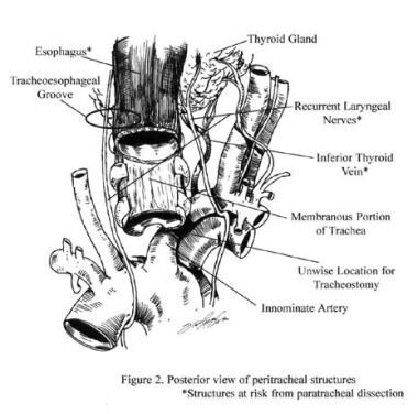 Posterior view of paratracheal structures. The ast