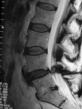 Lateral T2-weighted magnetic resonance imaging (MR