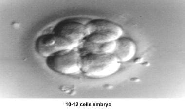 Infertility. Embryo (10- to 12-cell stage). Image 
