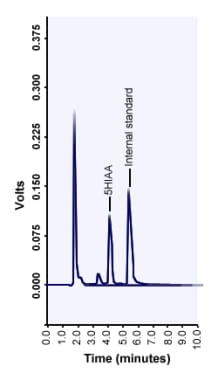 Chromatogram of 5-hydroxyindoleacetic acid (5-HIAA