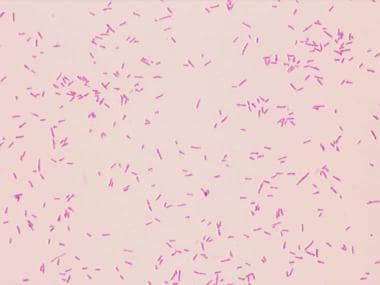 Gram stain of Yersinia enterocolitica.
