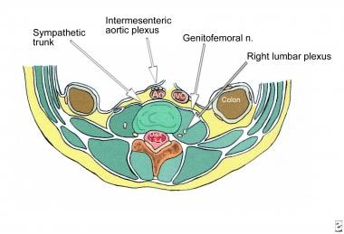 Pertinent anatomy for lumbar sympathetic block (cr