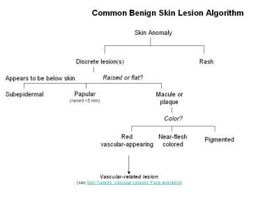 Common benign skin lesion algorithm. (Concept and 
