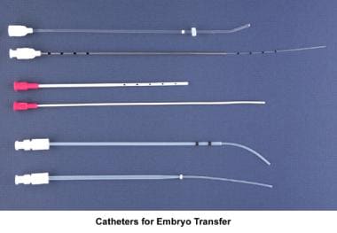 Infertility. Catheters for embryo transfer. Image 