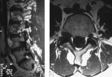 Lateral and axial magnetic resonance imaging (MRI)