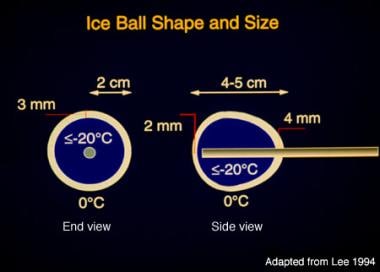 Diagram illustrating dimensions of a typical ice b