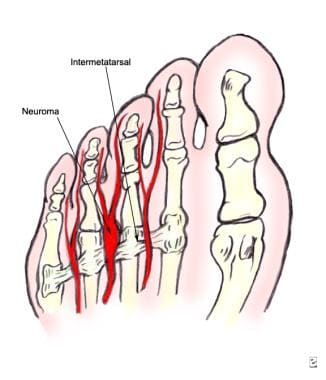 Plantar view showing the relationships between the