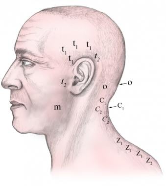 Lateral injection sites. 