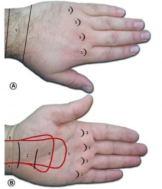 Surface anatomy of the left hand. A is the dorsum 