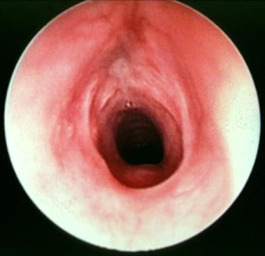Postoperative view of the same patient (a 4-month-