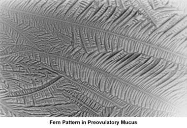 Infertility. Fern pattern of preovulatory mucus. I