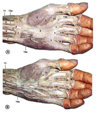 Palmar structures of the left hand. In A, the palm