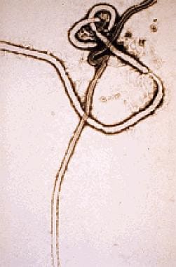 Ebola virus. Courtesy of the US Centers for Diseas