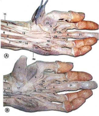 Palmar structures of the left hand. In A, the flex
