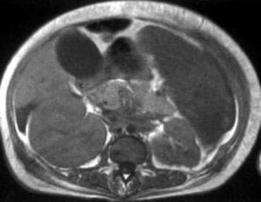 T1-weighted magnetic resonance image (repetition t