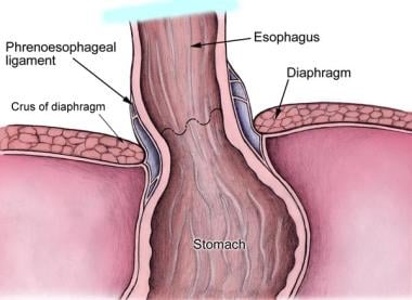 Anatomy of lower esophageal sphincter. 