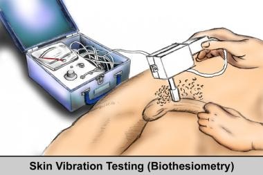 Vibrating Sensation In Penis 83