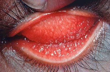 This image reveals a close view of a patient's lef