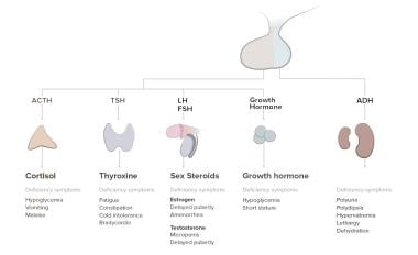 Pathophysiology of panhypopituitarism. 