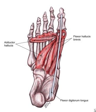 Plantar muscles that contribute to deforming force