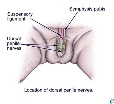 Penis Nerve Damage 88