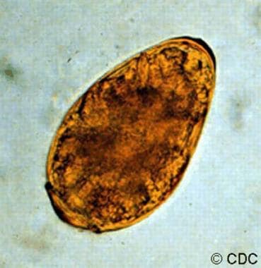 This micrograph depicts an egg from the trematode 