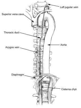 Chyle fistula. Anatomy of the thoracic duct in rel