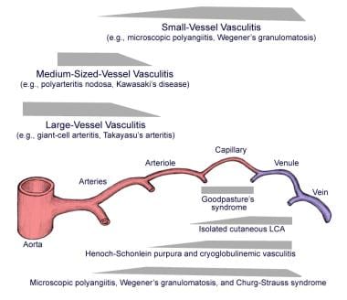 Preferred sites of vascular involvement by selecte