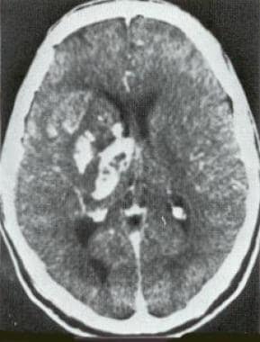 Contrast-enhanced computed tomography scan in a 50