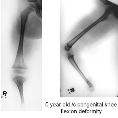 Part 1 of 5. This 5-year-old boy presented with a