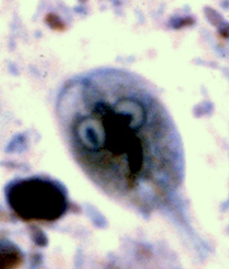 Giardiasis. Giardia trophozoite.
