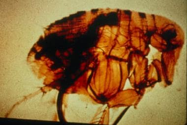 Pictured is a flea with a blocked proventriculus, 