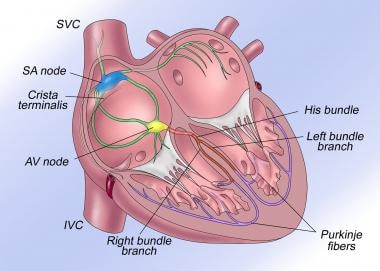 The normal cardiac conduction system is illustrate