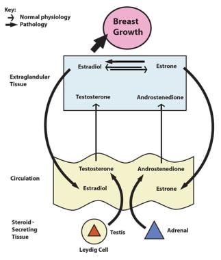 Pathophysiology of gynecomastia. Estradiol is the 