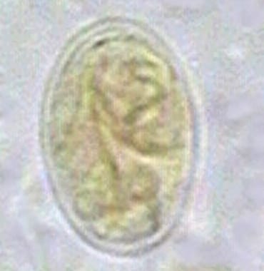 Giardiasis. Giardia cyst. 