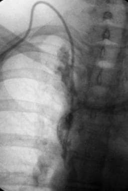 This contrast-enhanced study was obtained through 