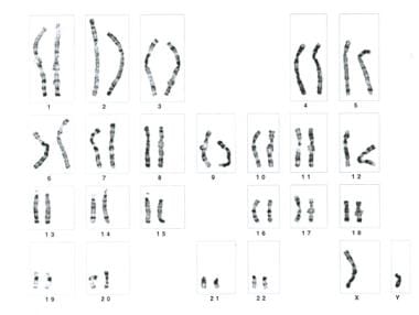 Prenatal diagnosis for congenital malformations an