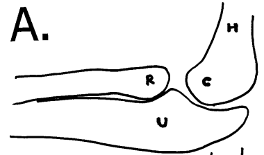 Landmarks on lateral elbow radiograph: radial head