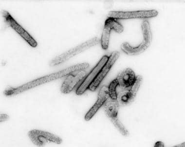 Marburg virus. Negative stain image courtesy of th