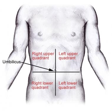 Division of the abdomen into 4 quadrants. 