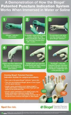 Poster for Biogel Puncture Indication System. 